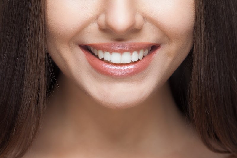 beautiful-white-teeth-and-smile-from-professional-teeth-whitening-in-ottawa